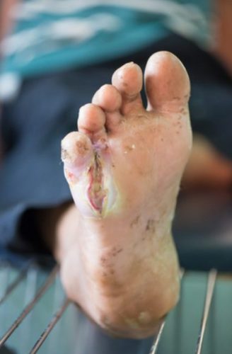 foot foot